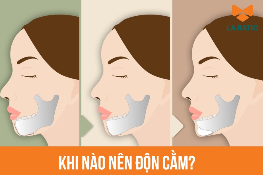 Bạn nên độn cằm khi khuôn mặt mất cân đối do cằm ngắn, lẹm hoặc thiếu độ nhô Bạn nên độn cằm khi khuôn mặt mất cân đối do cằm ngắn, lẹm hoặc thiếu độ nhô
