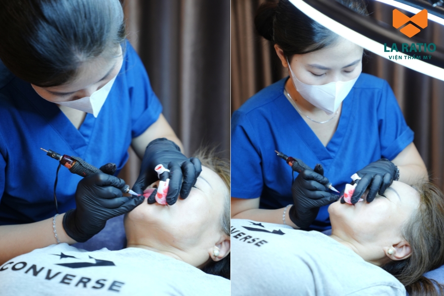 Quy trình phun môi an toàn, chuẩn Y Khoa tại Viện thẩm mỹ La Ratio