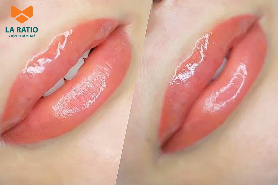 Môi màu cam san hô mang đến vẻ đẹp trẻ trung và phù hợp với mọi tông da